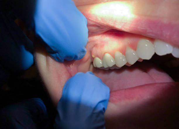 Best Emergency Dental Services for Seniors in Clay, AL