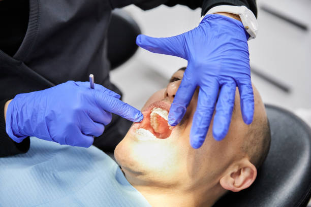 Best Emergency Dental Care for Abscessed Tooth in Clay, AL